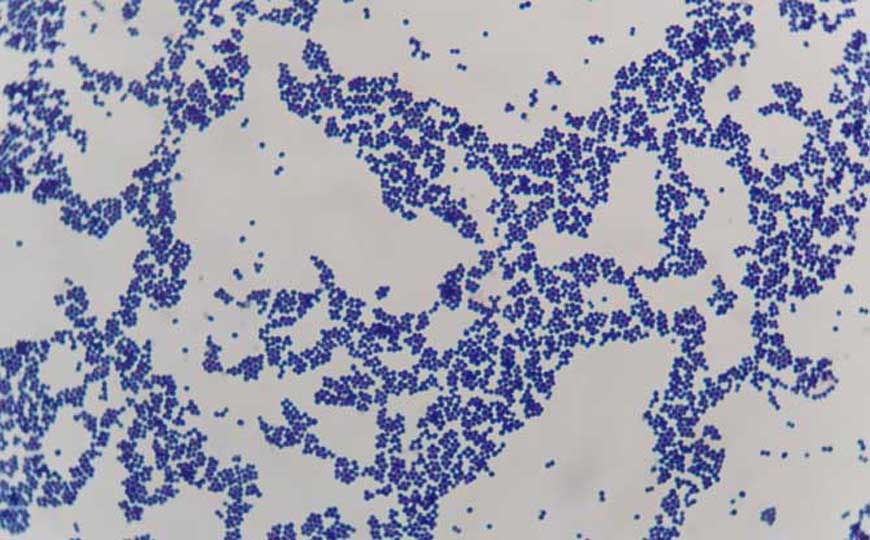 常见的细菌性食物中毒有哪些？