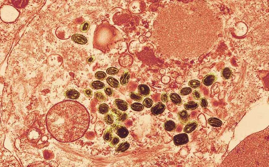 DNA病毒是什么意思？