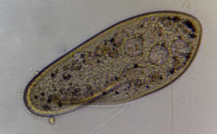 哪个动物没有心脏?