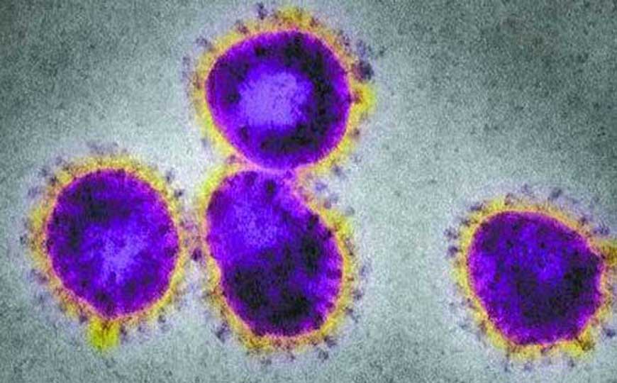 SARS病毒是什么病毒？