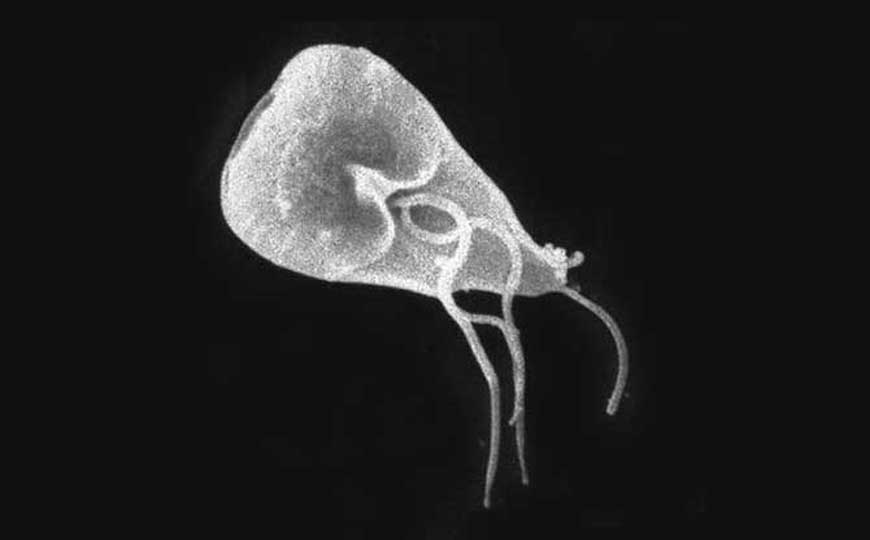 阿米巴原虫(阿米巴虫、食脑虫)